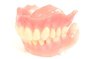 精密義歯（BPSデンチャー）